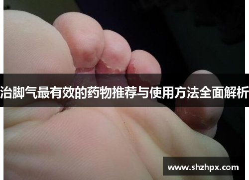 治脚气最有效的药物推荐与使用方法全面解析